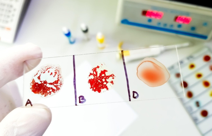 How A Rajkot Man Was Identified As Having The Uncommon Blood Type Emn-Negative
